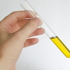 Una endocrinóloga del Hospital de Jaén premiada por un estudio sobre los beneficios del consumo de aceite de oliva