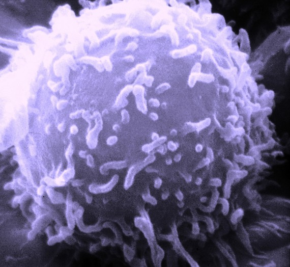 Científicos ingleses descubren una proteína que puede acabar con todos los cánceres